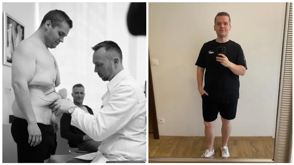 Ľubo si po Extrémnych premenách užíva život naplno. Takto vyzerá po operácii