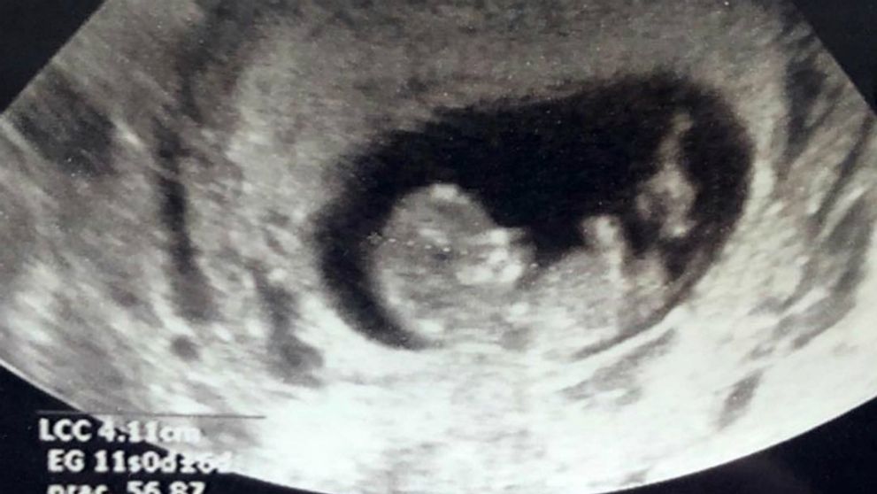 Známy herec sa pochválil radostnou správou: Bude trojnásobným otcom