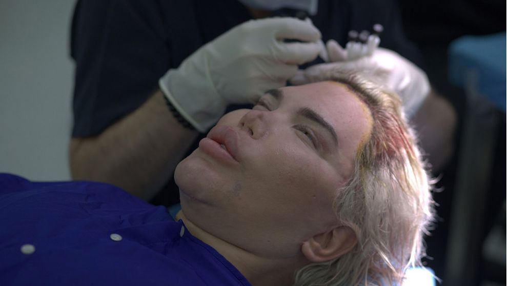 Najznámejší Ken všetkých šokoval: Po plastikách prišla najradikálnejšia premena