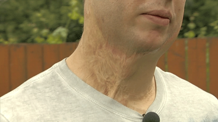 Tragédia pri grilovaní