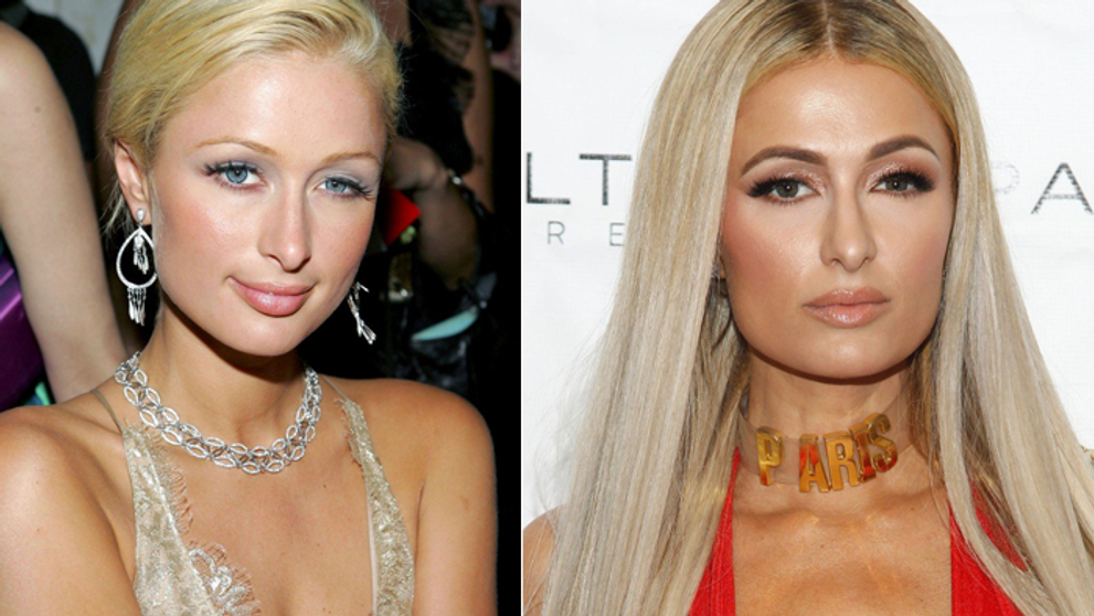 Paris Hilton popiera všetky plastiky. A toto je čo?!