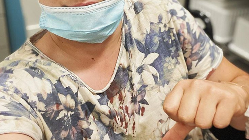 Superstarista skončil v nemocnici! Zrazil ho motocykel