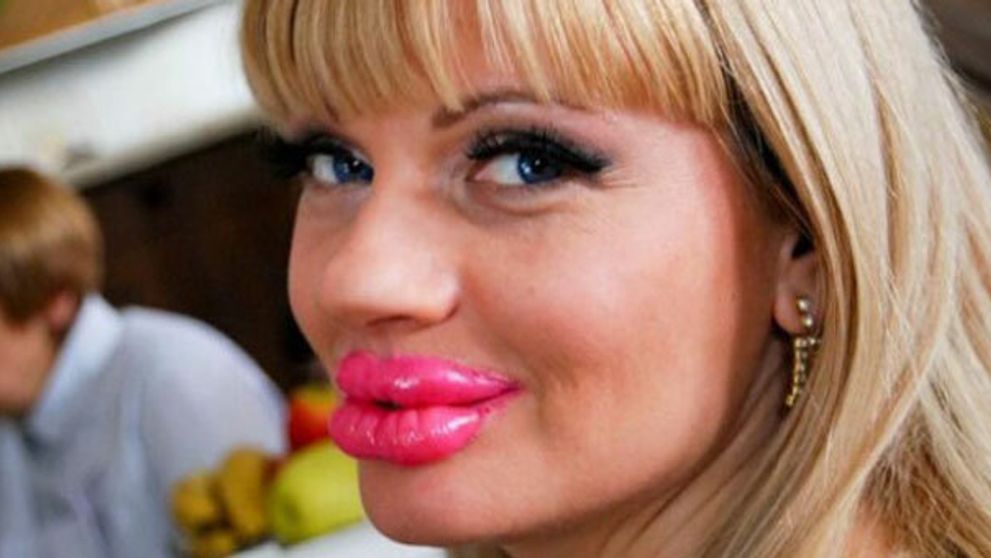 FUJ! Zmasakrované pery: Horšie ako kačice!