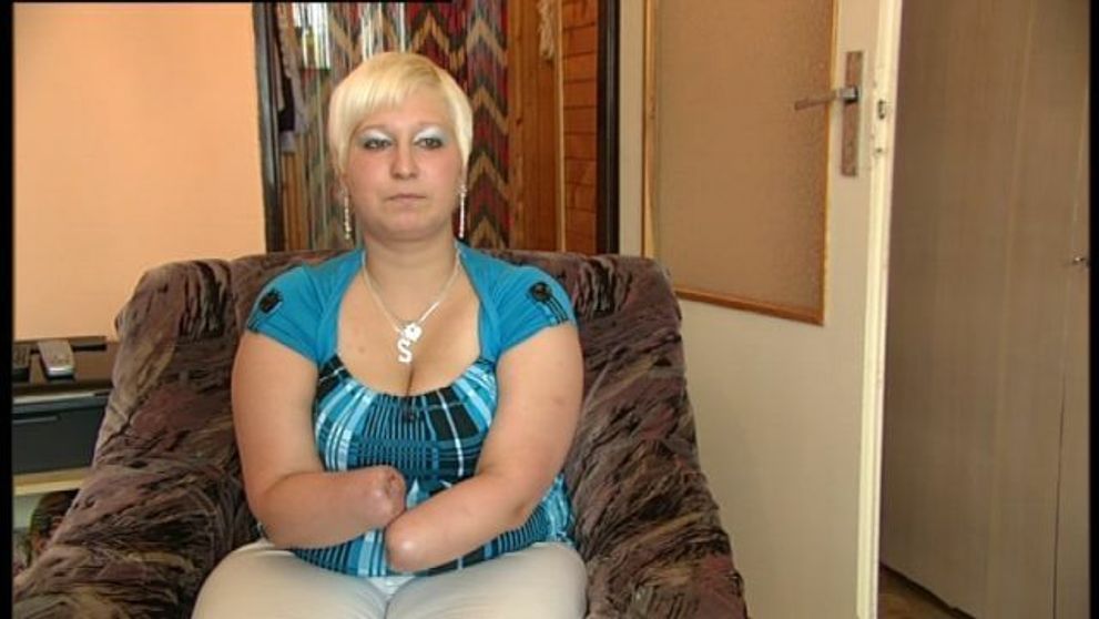 Lis jej odsekol obe ruky