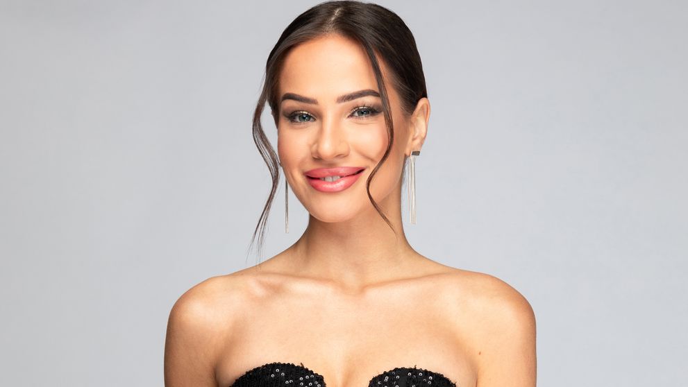 Anet z Ruže podstúpila plastickú operáciu. Čo si nechala vylepšiť?