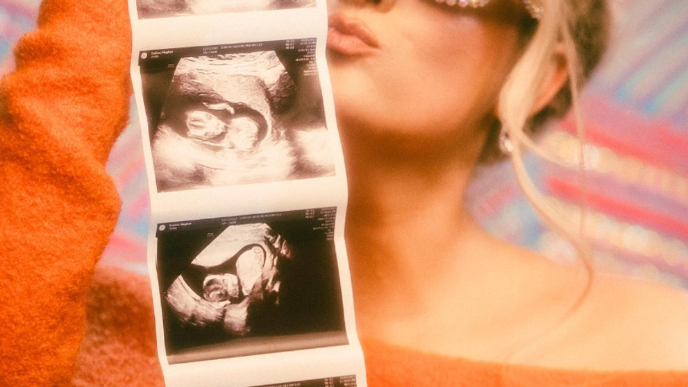 Aha, z koho bude dvojnásobná mama: A to už toto leto!