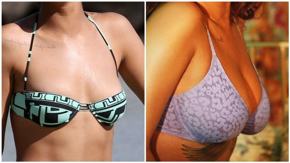 Neskutočný rozdiel! Viete, ktorej hviezde takto narástol dekolt?