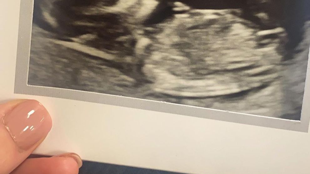 Reality hviezda v slzách. Dva dni po narodení jej dcérka náhle zomrela