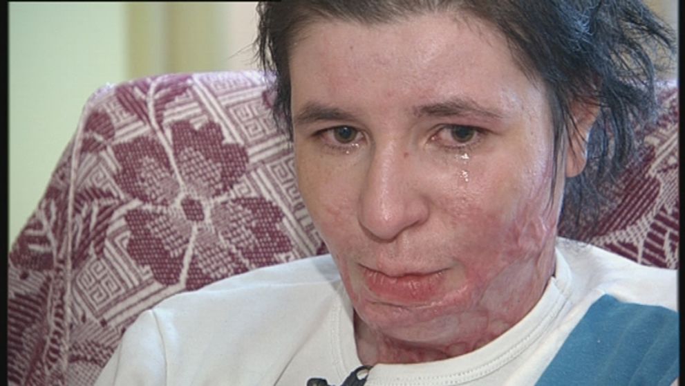 Renáte zničil život pokazený sporák