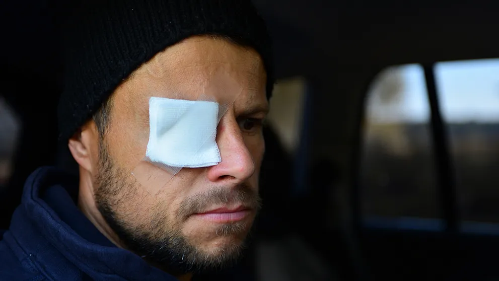 Rado skončil v nemocnici: Vážne problémy s okom ho môžu poslať domov!
