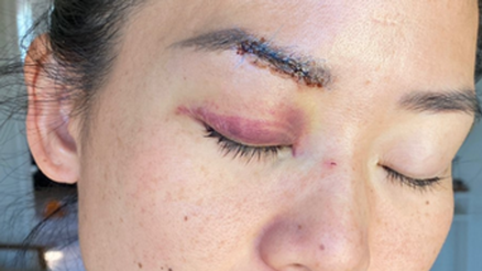 Hviezdu reality šou napadla bezdomovkyňa: Krv bola všade