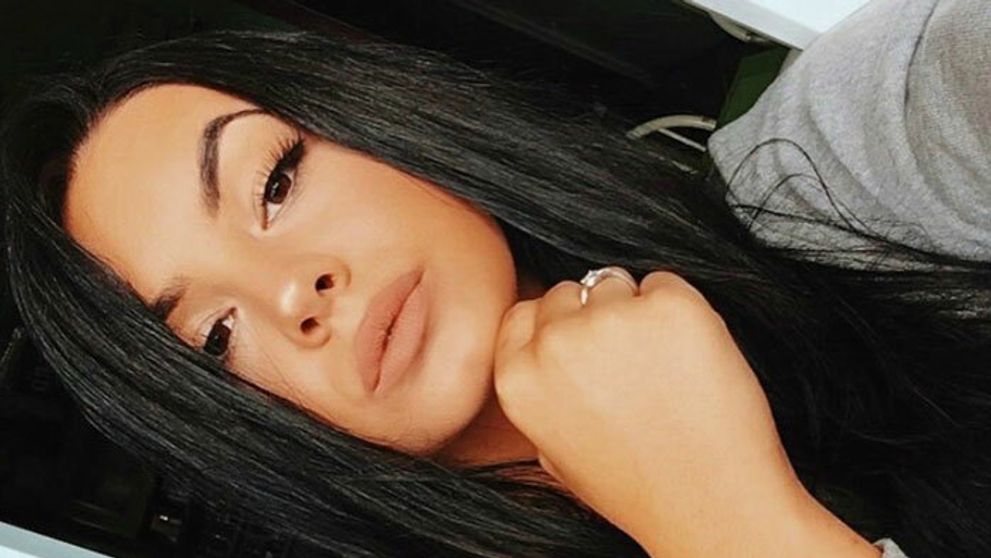 Exfarmárka Lula prekvapuje. Po zväčšení pier nové vlasy