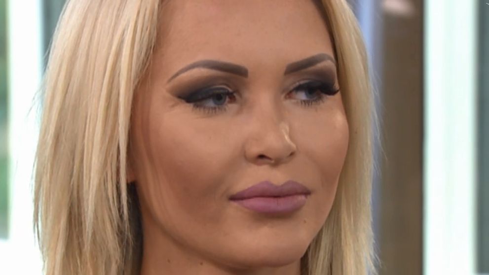 Má len 22 rokov a niekoľko plastík za sebou. Prezradila, koľko ju to stálo