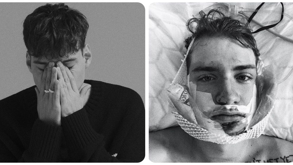 Ťažký osud českého hudobníka. Následky má doteraz!