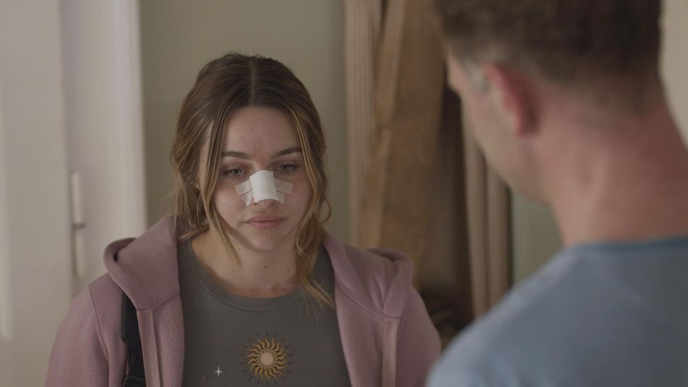 Absolvovala plastiku nosa. Výsledok je úžasný