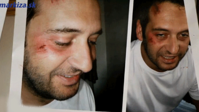 Martina Mňahončáka zrazilo auto!