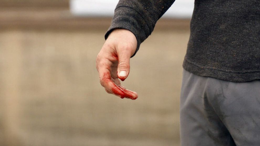 Súboj na ostrie noža: Vo farmárskej aréne potečie krv!