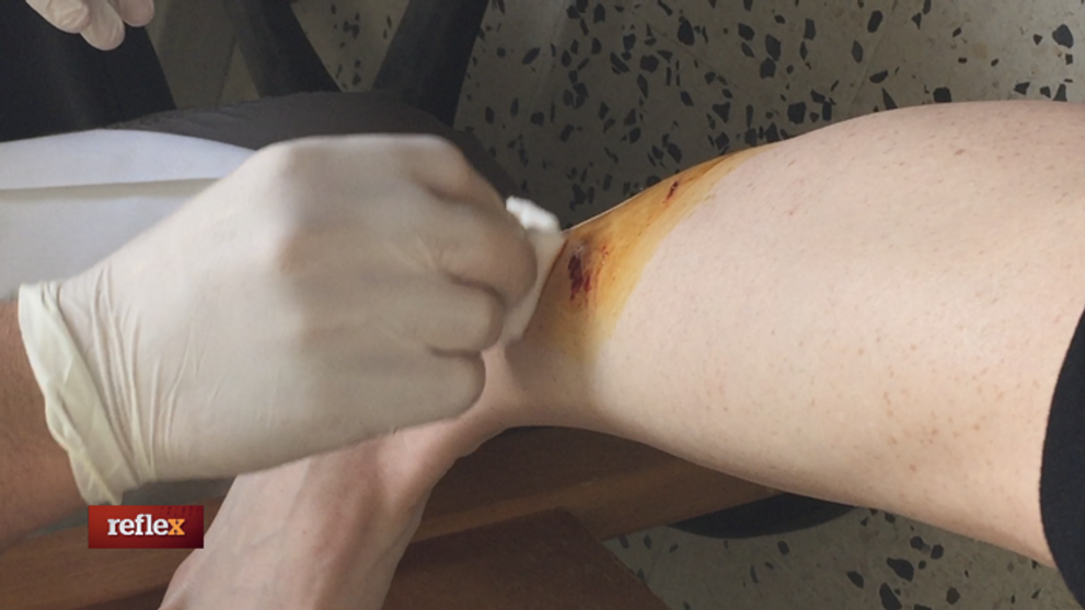 Pohryzená v Tunisku