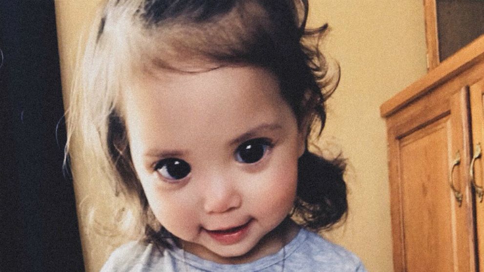 Dvojročné dievčatko vás upúta krásnymi očami: To však neviete, prečo ich také má