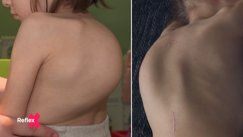 So Sárkou mama vyše 5 rokov chodila po lekároch, no tí nevedeli určiť jej diagnózu