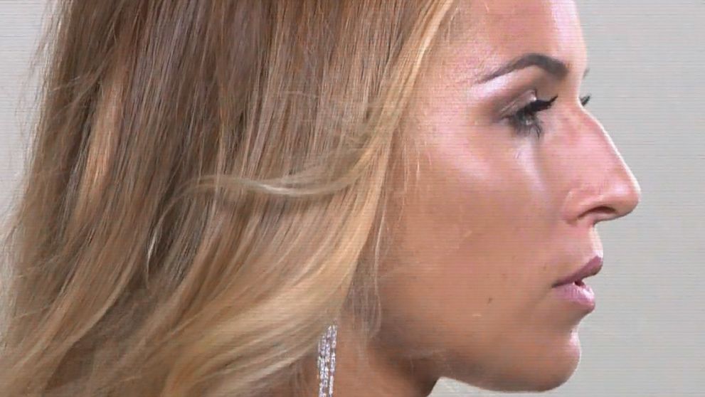 Horúce fotenie Cibulkovej. Stačil silnejší vietor a prsia by boli vonku