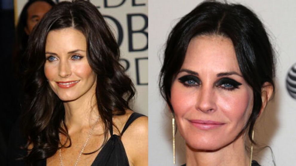 Moniku z Priateľov menia plastiky: Kam to až chce dotiahnuť?