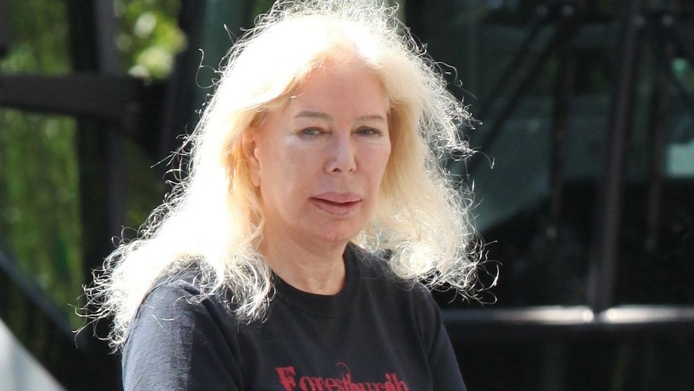Krásna sestra zo seriálu M*A*S*H sa zmenila na plastikovú kreatúru