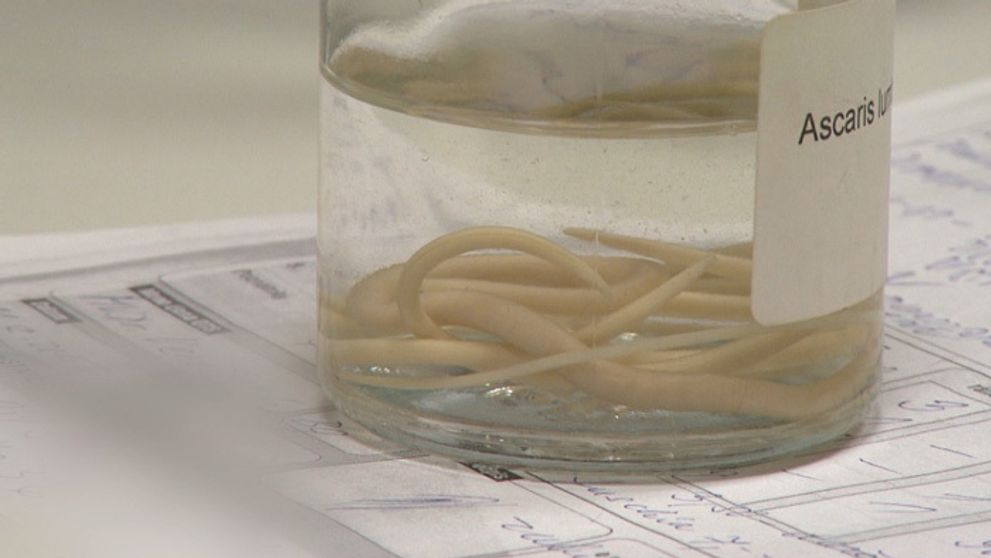 Šmejdi prichádzajú s novými praktikami: Vyšetrenie na parazity