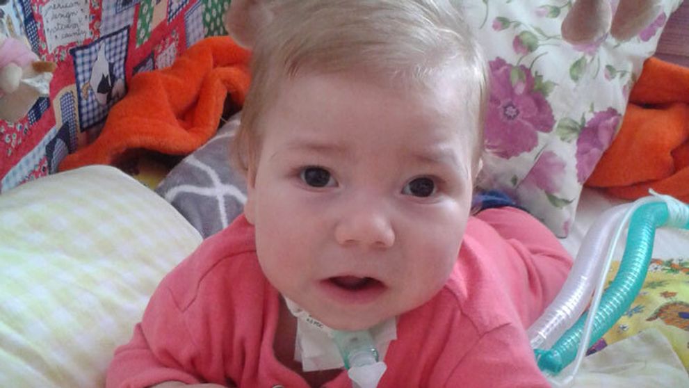 Jakubko sa narodil s tachykardiou srdiečka. Na jednu diagnózu sa postupne nabaľovali ďalšie