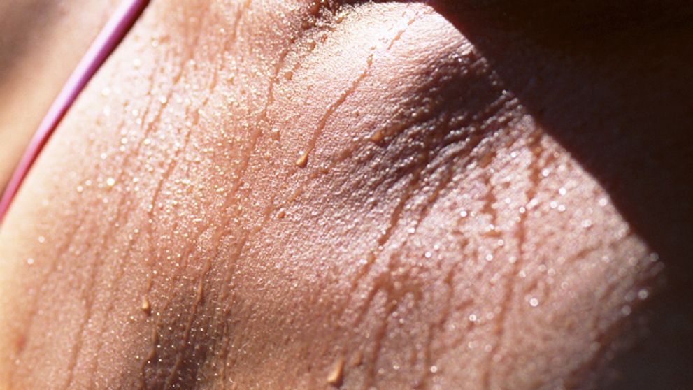 Trápi vás nadmerné potenie? VIEME, ako sa ho zbaviť!