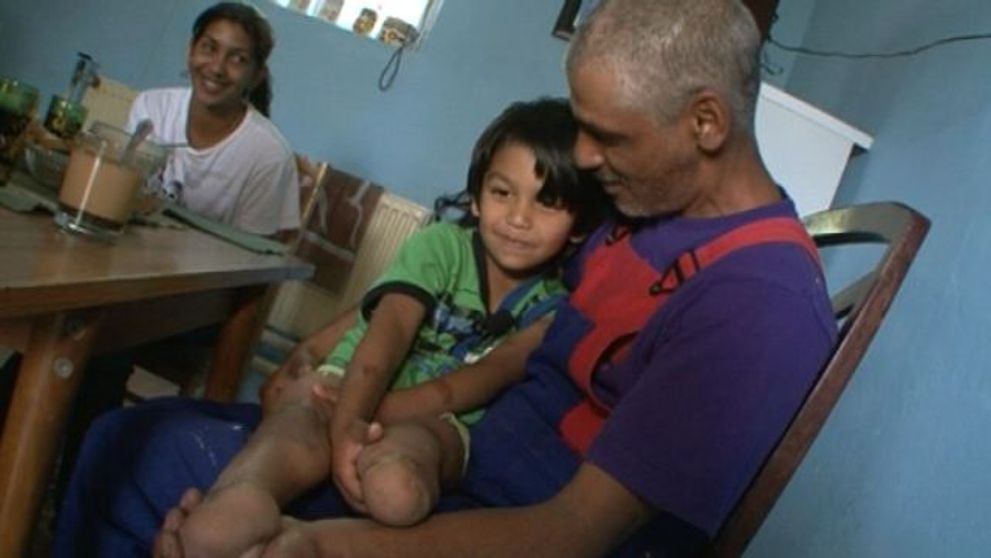 Sašovi zničila život nebezpečná baktéria