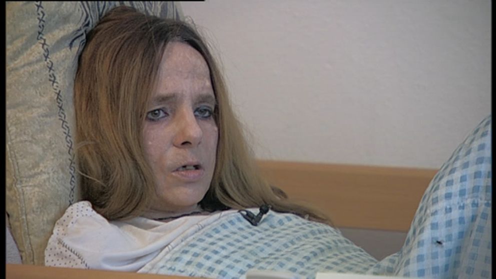 Erikin život ničí obrovský tumor