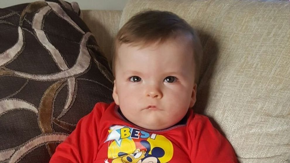 Tento chlapec sa nikdy neusmeje. Trpí vzácnou chorobou