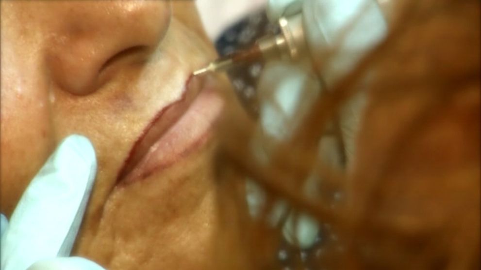 Permanentný make up! Výsledok nemusí byť vždy ideálny!