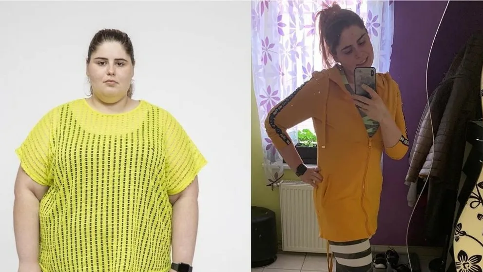 Silvia z Extrémnych premien si opäť ľahla pod nôž: Prečo ju nasledovali aj ďalší?