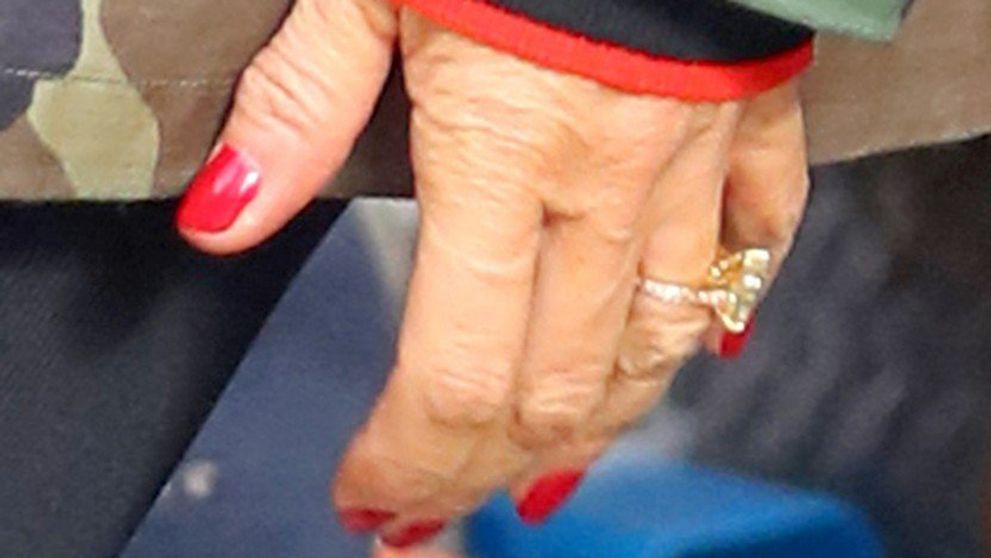 Viete, koho sú tieto vráskavé ruky? Tvár má pritom dokonale vyhladenú