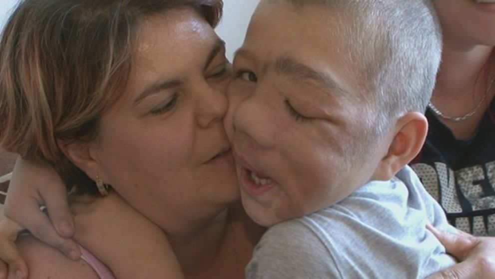 Samko má zdeformovanú tvár