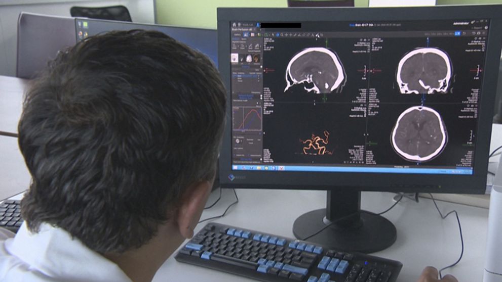 Aneuryzma môže končiť fatálne