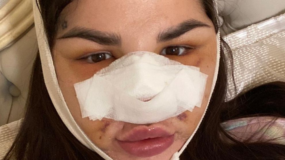 Zuzana Strausz Plačková prekvapila fotkami. Toto je pravda o mojej plastike!