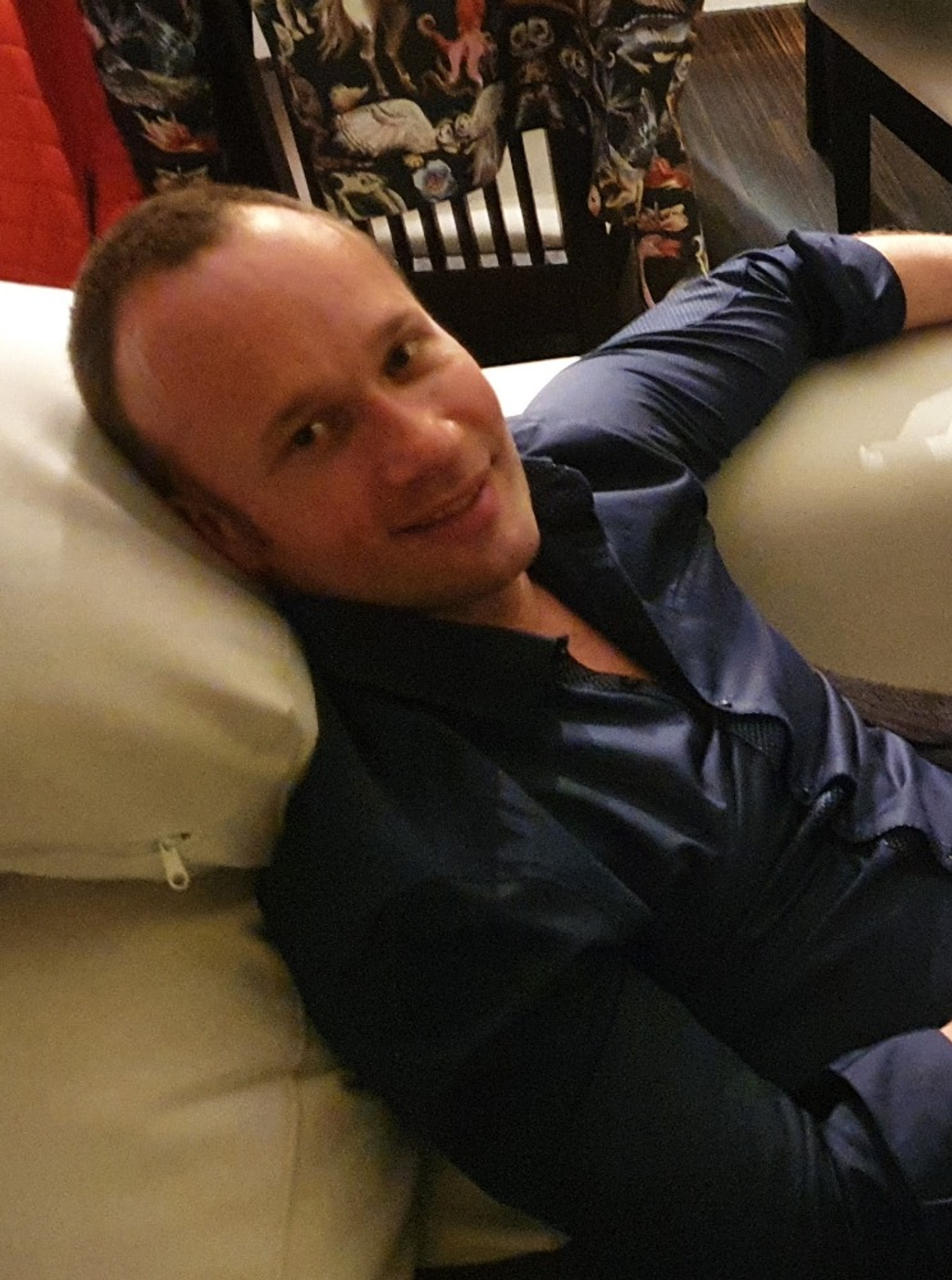 Romanovi pred zákrokom prekážali kúty a vysoké čelo.