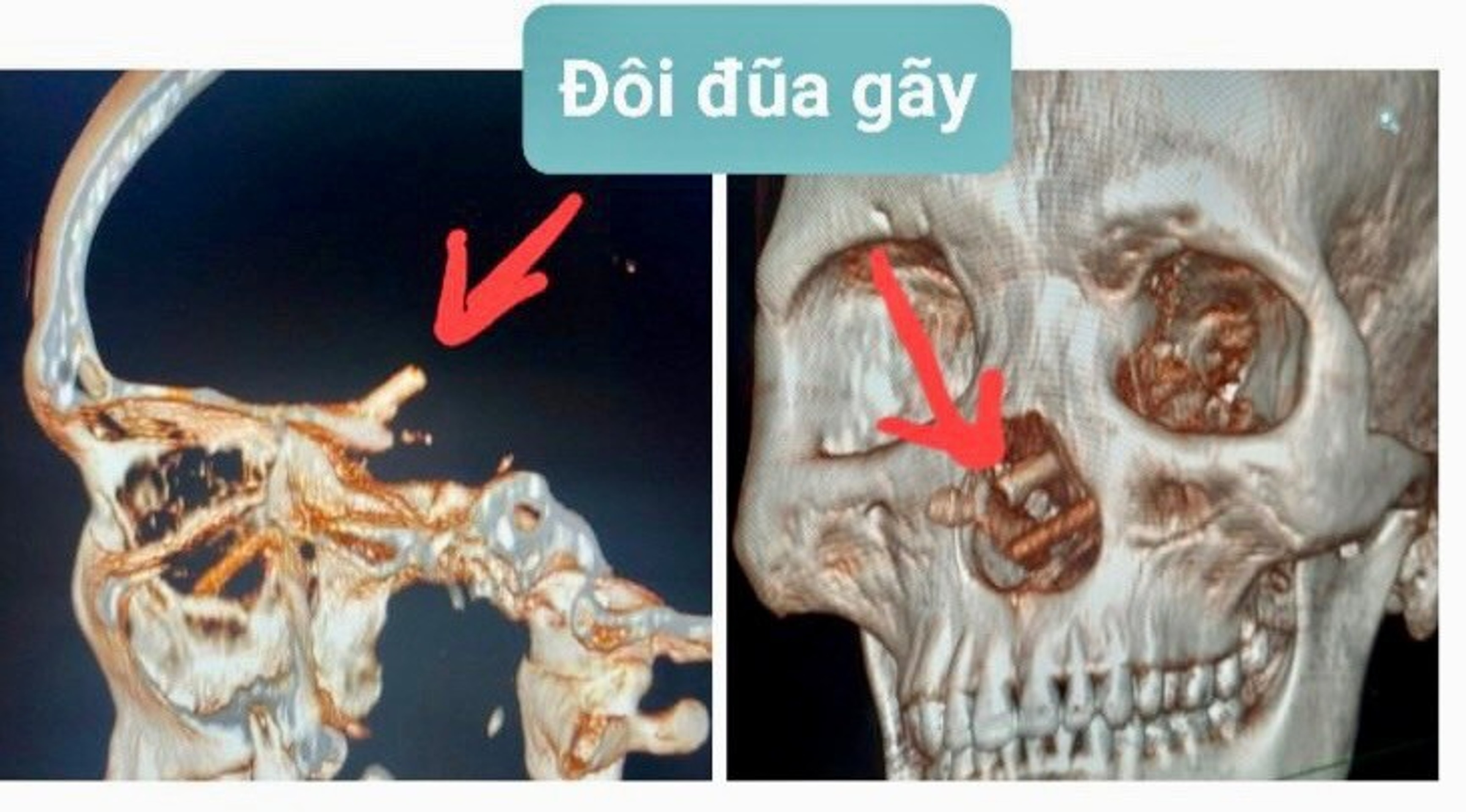 Snímka z počítačového tomografu.