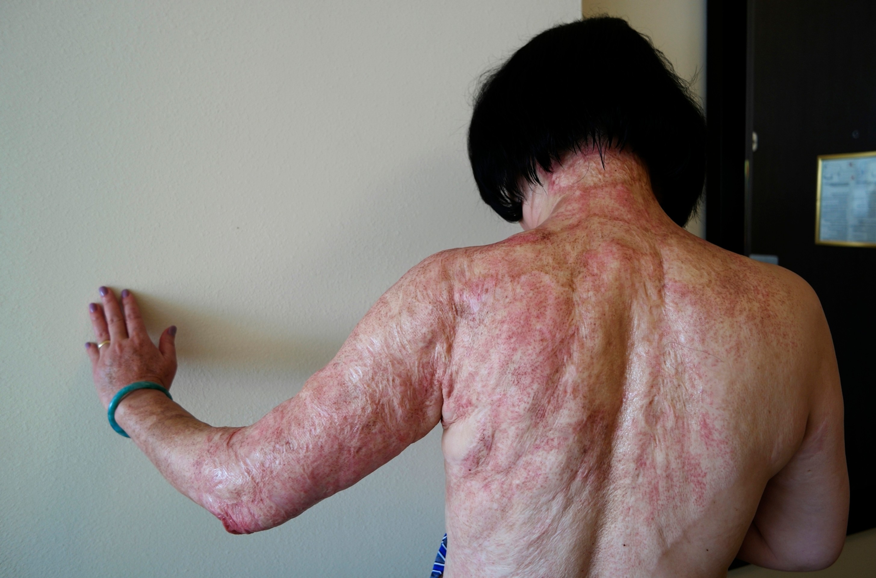 Kim Phuc