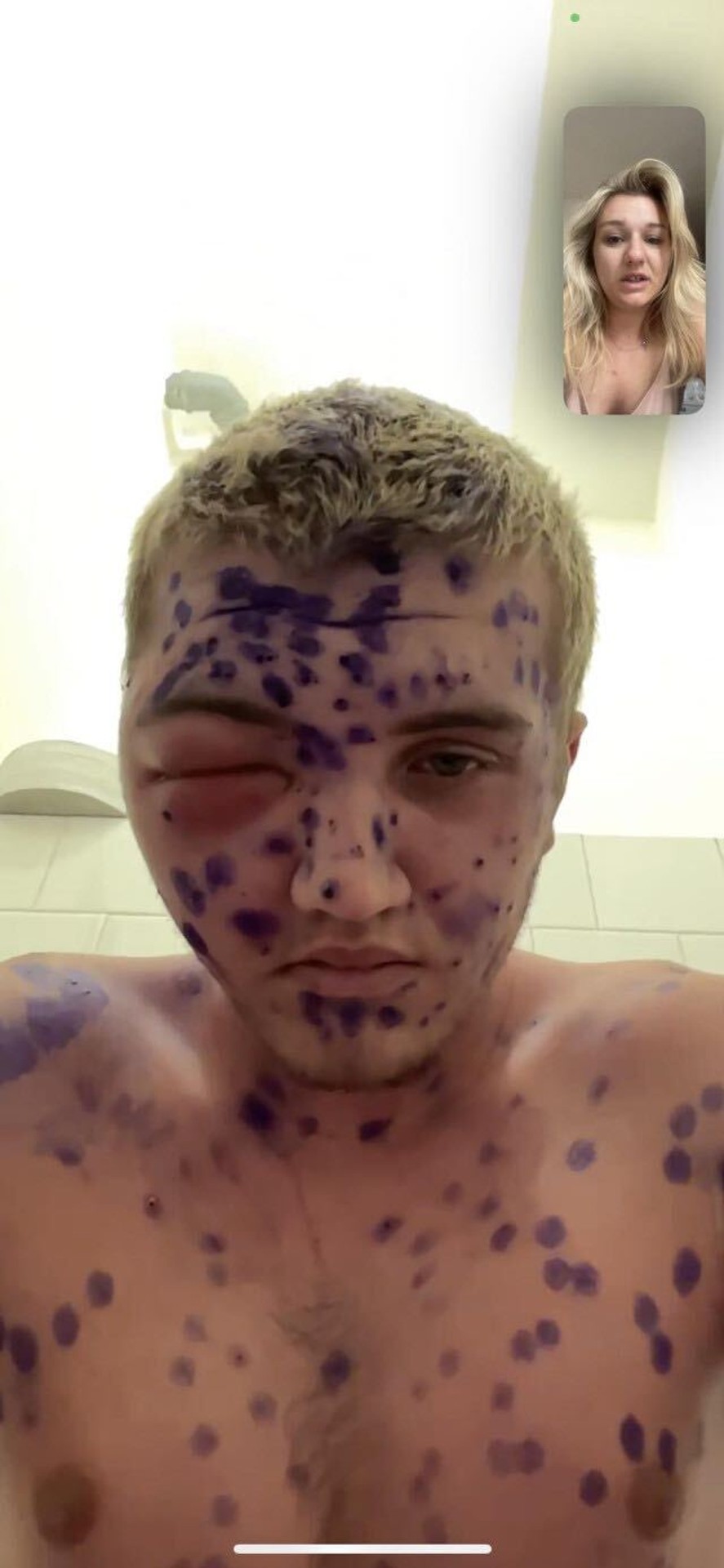 Kiahne spustili lavínu zdravotných problémov