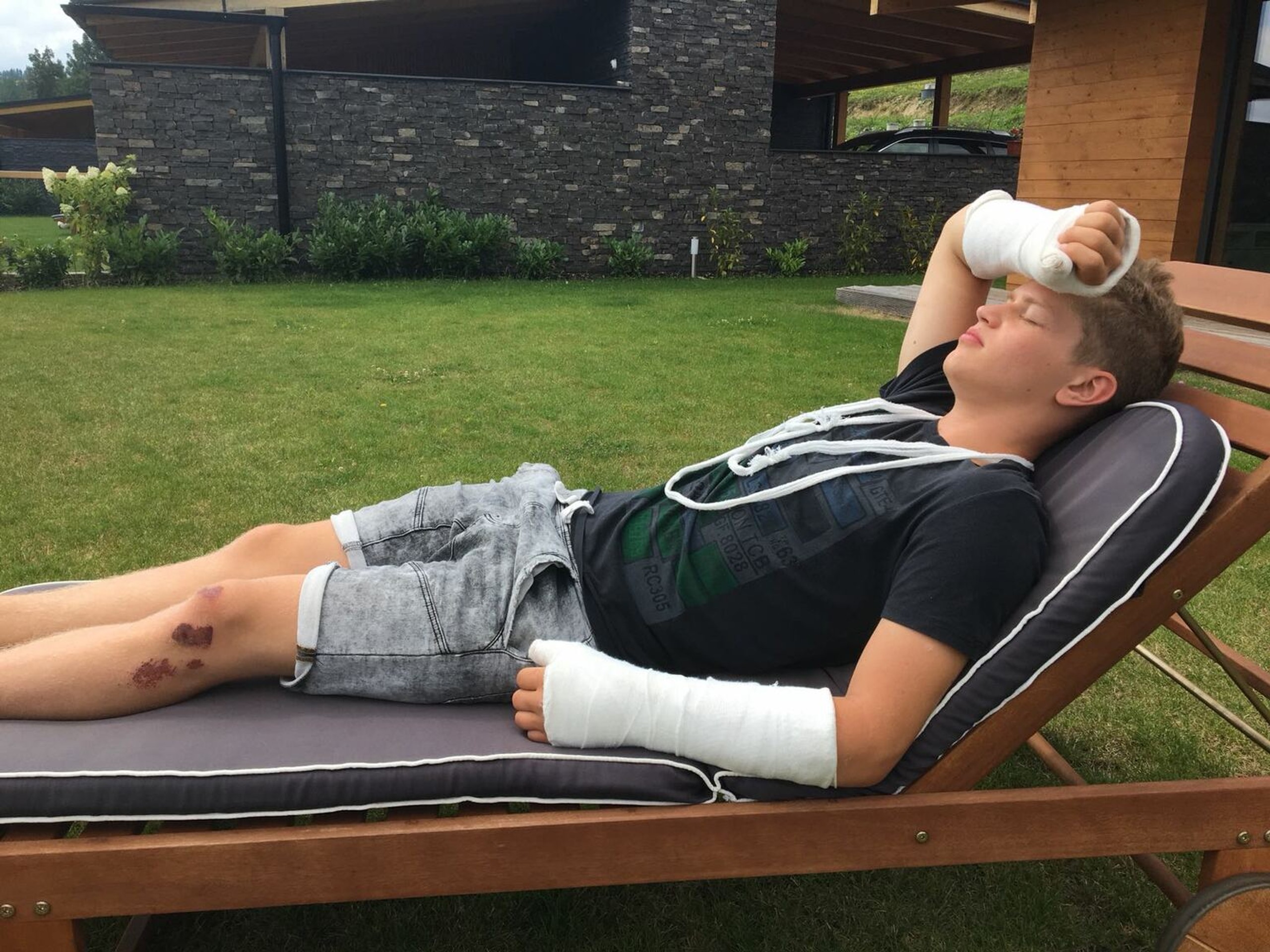 Oliver Oswald po nehode! 