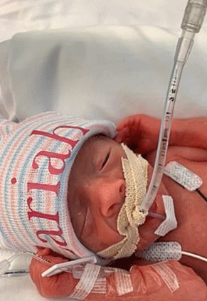 Chceli ešte jedno dieťa. Lesbickému páru sa však narodili pätorčatá