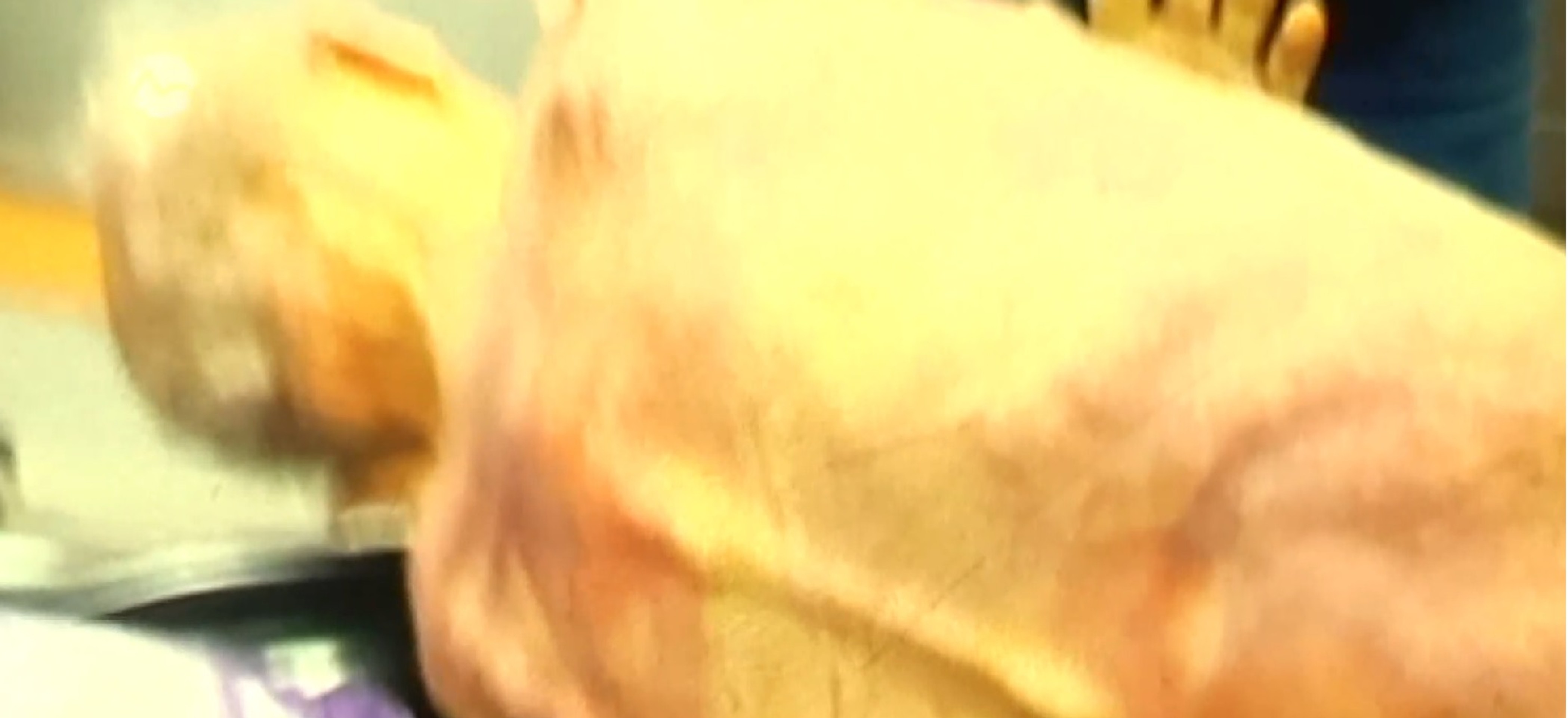 Otec pani Andrey mal preležaniny a drobné rany po tele.