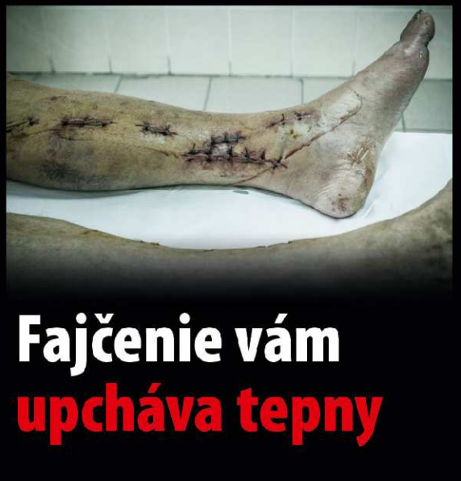 Varovanie, čo všetko môže spôsobiť fajčenie