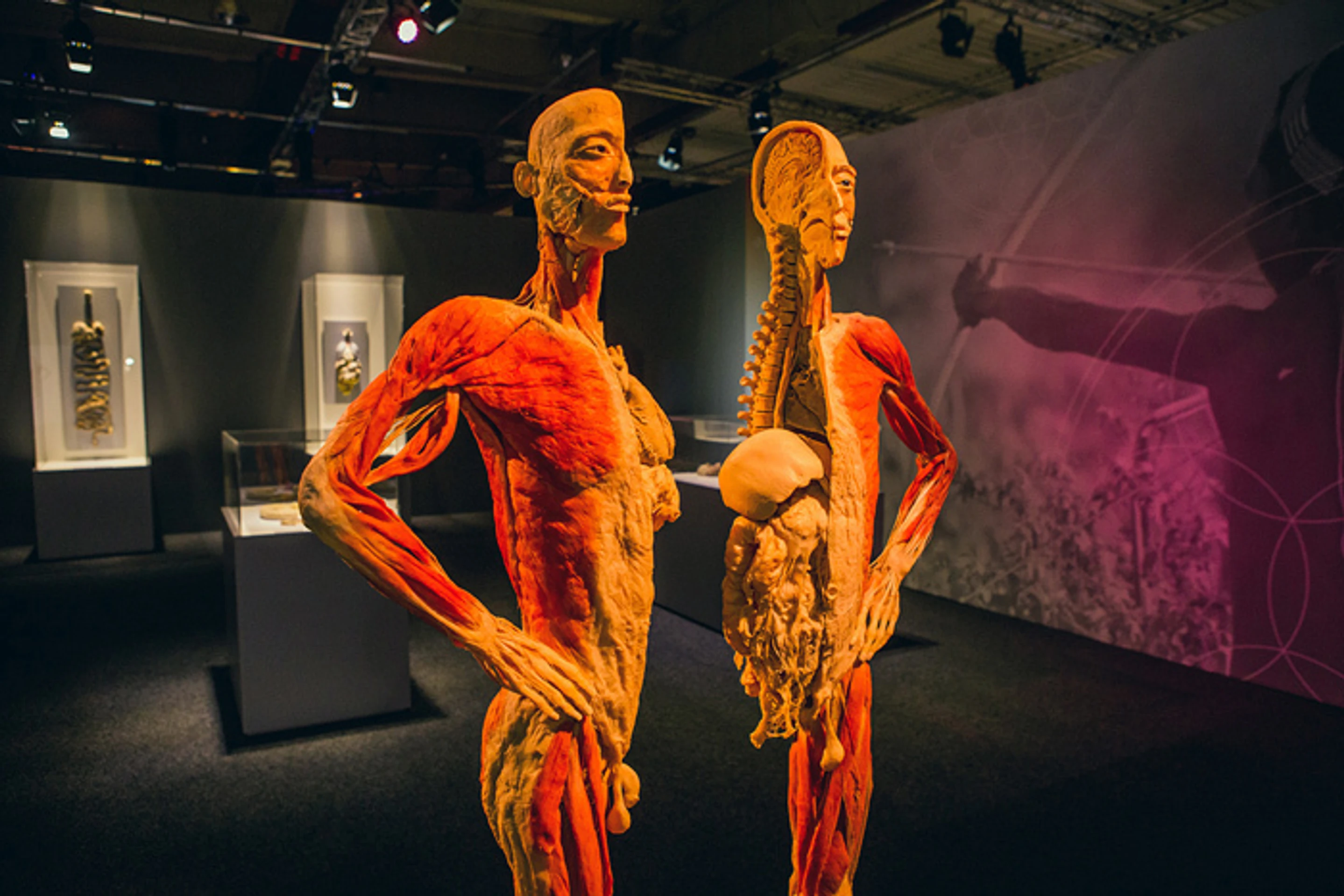 Exponát z výstavy Body The Exhibition.